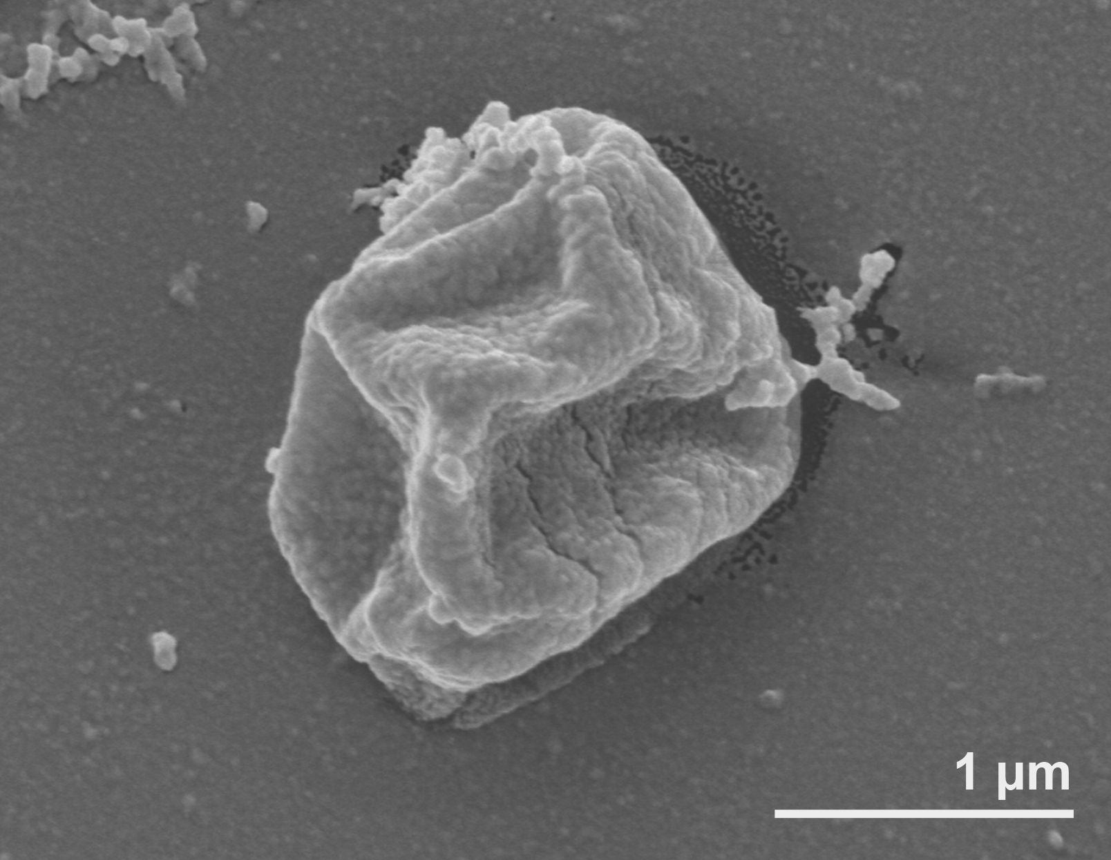 Electron microscope image of Pyrolobus fumarii showing irregular coccoid cell structure